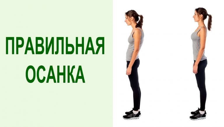 Правильная осанка, как ее исправить и сохранить