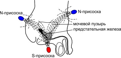 Магнитные присоски хаси отеки на ногах