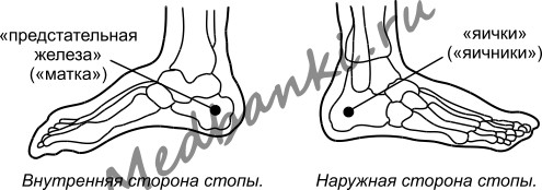 2. Ишемическая болезнь сердца, лечение присосками Haci