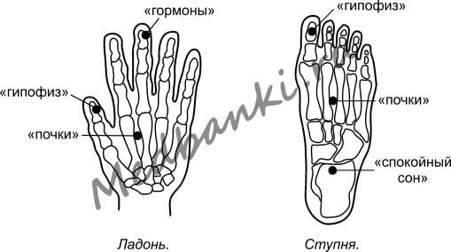 18. Бессонница, лечение присосками Haci