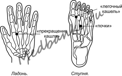 26. Бронхиальная астма, лечение магнитными банками Haci