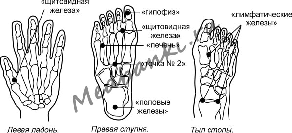 45. Гипертиреоз, лечение присосками HACI