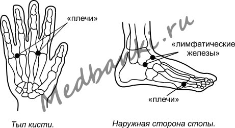 49. Плечелопаточный периартрит, лечение присосками HACI